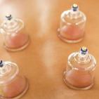Bell shaped cups are applied with suction to help lift and separate underlying tissue.